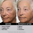Before and after comparison of face tightener product showing reduced wrinkles and firmer skin appearance.