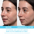 Side-by-side comparison of woman's face showing skin texture before and after product application.