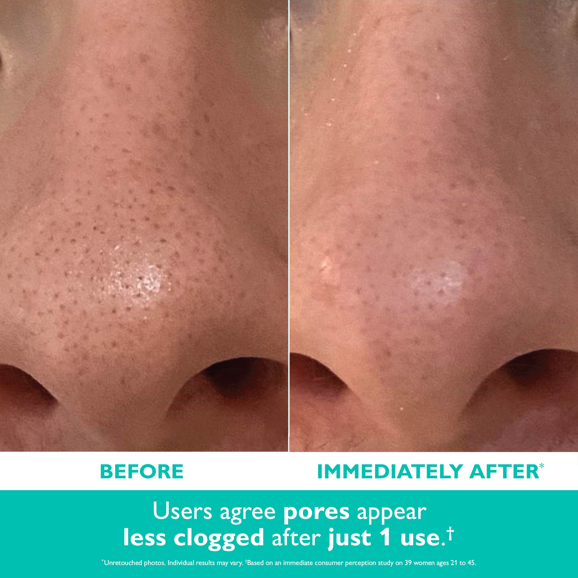 （新品）D'ISM EMS Pore Decrease & Lift Brus Even Smoother™ Microdermabrasion Exfoliating Pore Purifier|50 ml / 1.7