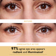 Close-up of brown eyes showing under-eye area before and after application of eye patches.
