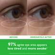 Close-up comparison of eye area before and after treatment, showing reduced appearance of under-eye texture and lines.