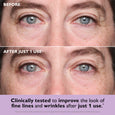Close-up of eye area showing fine lines and under-eye skin texture before and after application of eye patches.