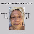 Before and after comparison of eye area showing reduced appearance of wrinkles and sagging skin around eyes.