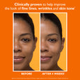 Side-by-side comparison of a person's face showing skin appearance before and after four weeks of treatment against an orange