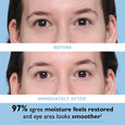 Before and after comparison of eye area showing reduced puffiness and smoother skin texture.