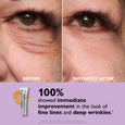Before and after eye area comparison showing reduced appearance of wrinkles and fine lines, with product tube displayed.