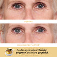 Before and after comparison showing eyes with reduced wrinkles and a gold eye patch product with applicator.