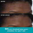 Comparison showing forehead area before and after two hours of peptide infused face and eye tape application on person with b