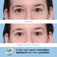 Person's face showing before and after comparison of under-eye area with green eye patches and product container displayed.