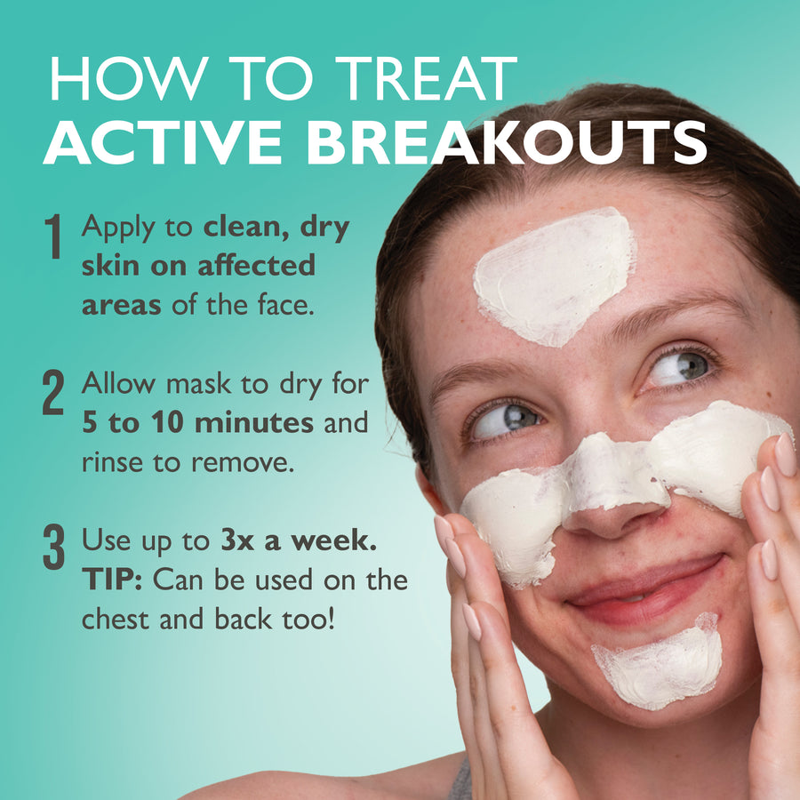 Based Mask Even Clearer™ Therapeutic Sulfur Mask
