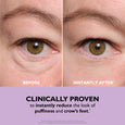 Before and after comparison of eye area showing reduced under-eye puffiness and smoothed skin texture.
