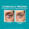 Before and after comparison of under-eye area showing reduced puffiness and fine lines around the eye.