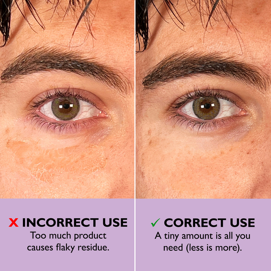 Before and after comparison of eye area showing incorrect and correct application of eye tightener formula.