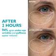 Before and after comparison of under-eye area showing application of peptide-infused face and eye tape.
