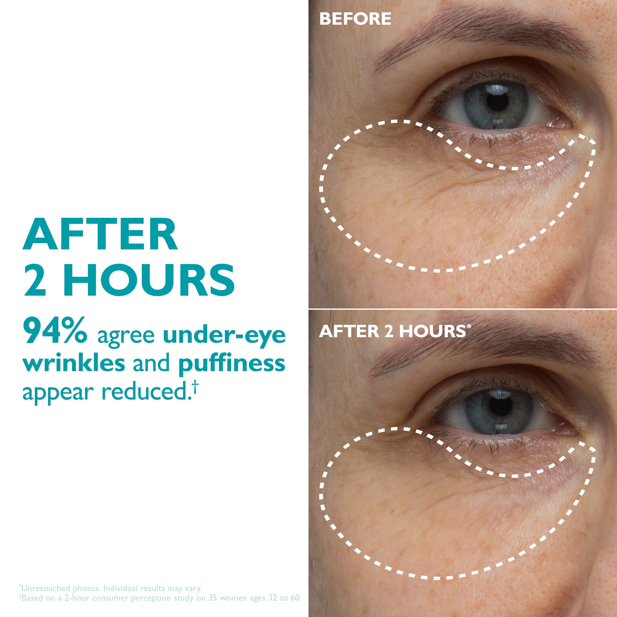 rm glutathione injection before and after Serum | Antioxidant Anti-Aging Serum Peptide Skinjection Peptide Infused Face