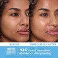 Before and after comparison of facial skin showing reduced under-eye darkness and increased skin radiance with cream product.