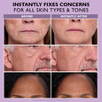 Before and after comparison showing facial skin with reduced appearance of wrinkles and sagging on three different individual