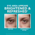 Before and after comparison showing an eye area with reduced dark circles and puffiness on a teal background.