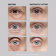 Before and after eye comparison showing reduced wrinkles and firmer appearance around eye area.