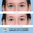 Before and after comparison showing eye area with product jar below; text describes smoother, hydrated appearance.