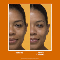 Potent-C Brightening Vitamin C Moisturizer
