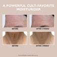 Before and after comparison showing forehead wrinkles and neck creases on skin.