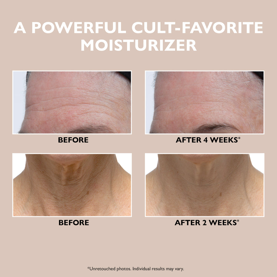 Before and after comparison showing forehead wrinkles and neck creases on skin.
