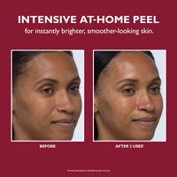 Even Smoother Instant Reveal Facial Peel 