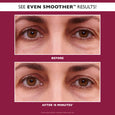 Before and after comparison of eyes with visible fine lines and under-eye area, showing reduction in appearance of wrinkles.