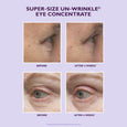 Super-Size Un-Wrinkle Eye Concentrate 30ml shown with before and after results on eye area skin.