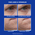 Before and after comparison showing eye area and chin with fine lines, displayed on blue background with white text labels.